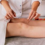 pain management accupunture auckland