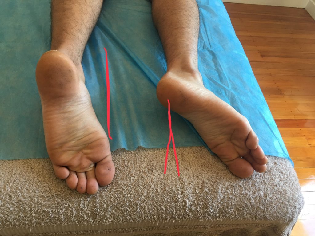 [multi photo] Looking for the reason of lower back pain from the ...