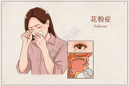 过敏性鼻炎，鼻炎，花粉症，干咳、鼻塞、头痛、流鼻涕、打喷嚏、眼睛痒，