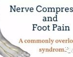 ACUPUNCTURE, ANKLE SPRAIN, AUCKLAND, LAMPING, NEW ZEALAND, STANDING PAIN, SUPERFICIAL PERONEAL NERVE ENTRAPMENT SYNDROME