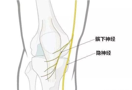 【黄博士神经卡压医案】膝关节内侧刺痛,少见隐神经髌下支卡压一例 - Auckland Acupuncture and Chinese ...