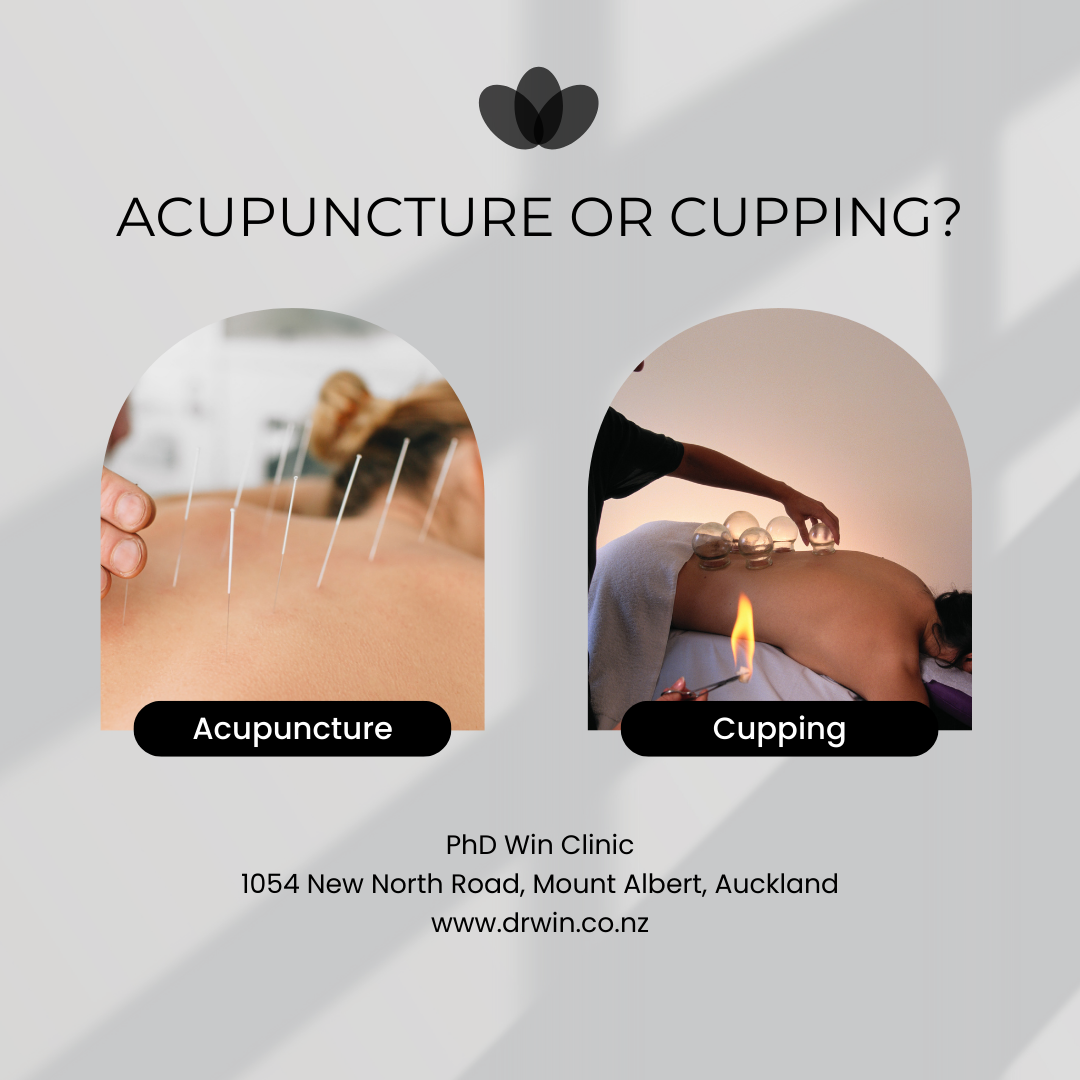 auckland, acupuncture,pain urination,urination frequently, frequent urination, lower back pain, hurry urination,, newzealand, acupuncture, hip pain, pseudosciatica.gluteal epithelial nerve entrapment,
