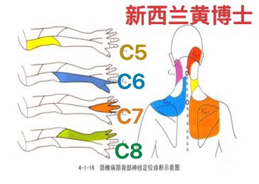 手麻，手痛，上肢麻，上肢痛，手无力，上肢无力，奥克兰，新西兰，中医，针灸