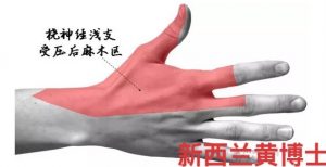 Remove term: 手麻木，无力，疼痛，手麻，手腕痛，前臂痛，奥克兰，新西兰，微针刀 手麻木，无力，疼痛，手麻，手腕痛，前臂痛，奥克兰，新西兰，微针刀