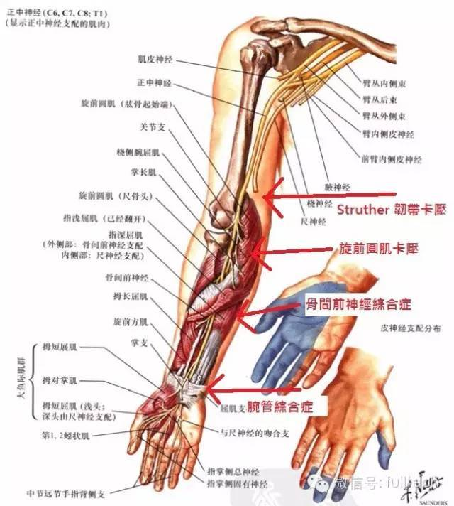 手麻木，手痛，手无力，麻醒，奥克兰，新西兰，中医，针灸