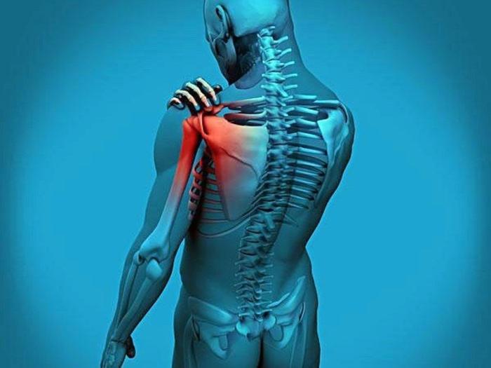 肩痛，肩部刺痛，肩部过电痛，肩膀活动受限，肩膀抬不起来，五十肩，肩凝症，肩周炎，神经痛，神经卡压，奥克兰，新西兰，中医，针灸，微针刀