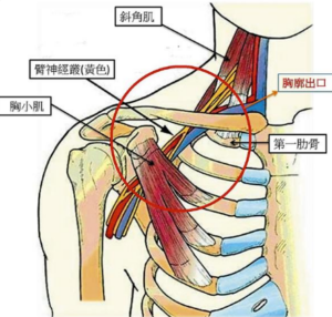 右手阵发性麻木， 右上肢下垂手发麻， 开车时手发麻|，右肩背部不适 酸胀， 黄博士奥克兰中医针灸诊所，麻木时手颜色改变