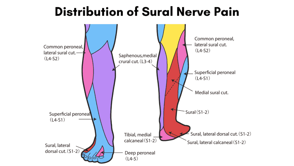 lateral sural cutaneous nerve entrapment ,sharp pain knee, severe leg pain, common peroneal nerve, phd win acupuncture clinic