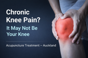 knee pain swelling acupuncture auckland