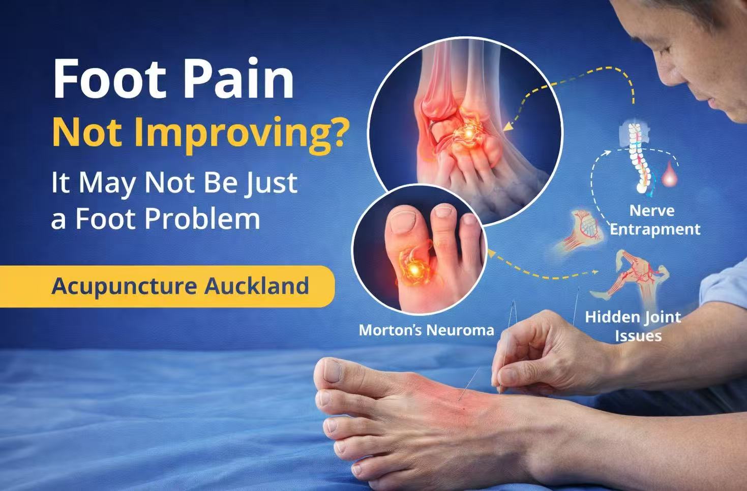 foot pain auckland acupuncture