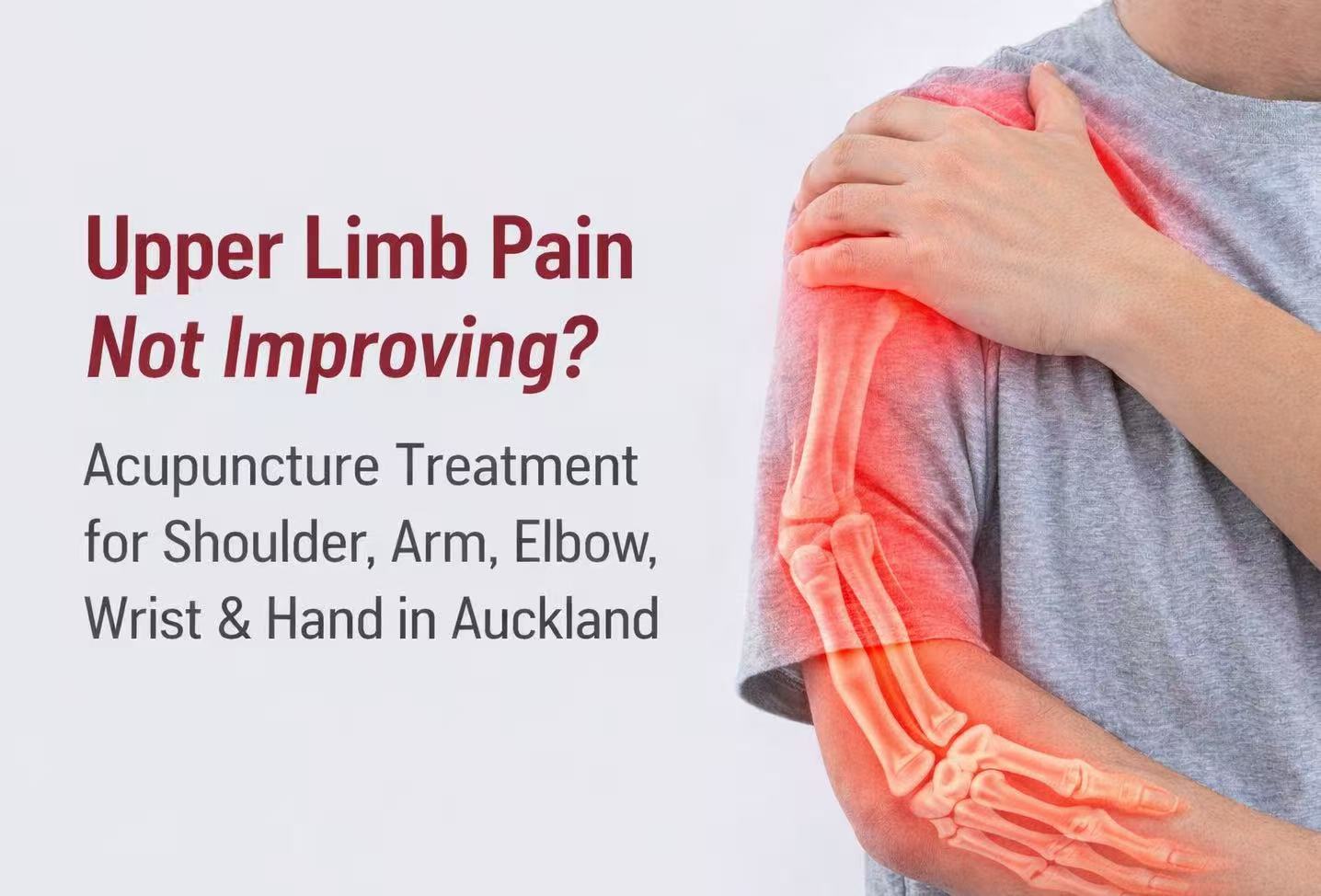 upper limb pain auckand acupuncture