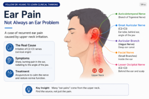 ear pain auckland acupuncture