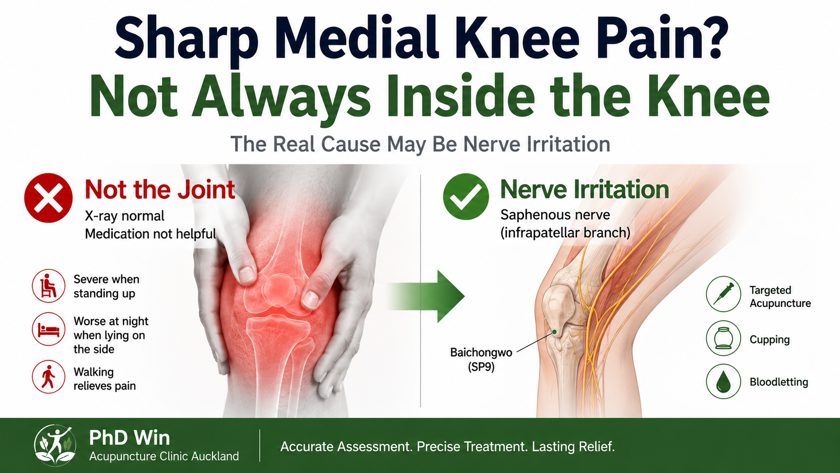 inner knee pain acupuncture auckland nerve pain