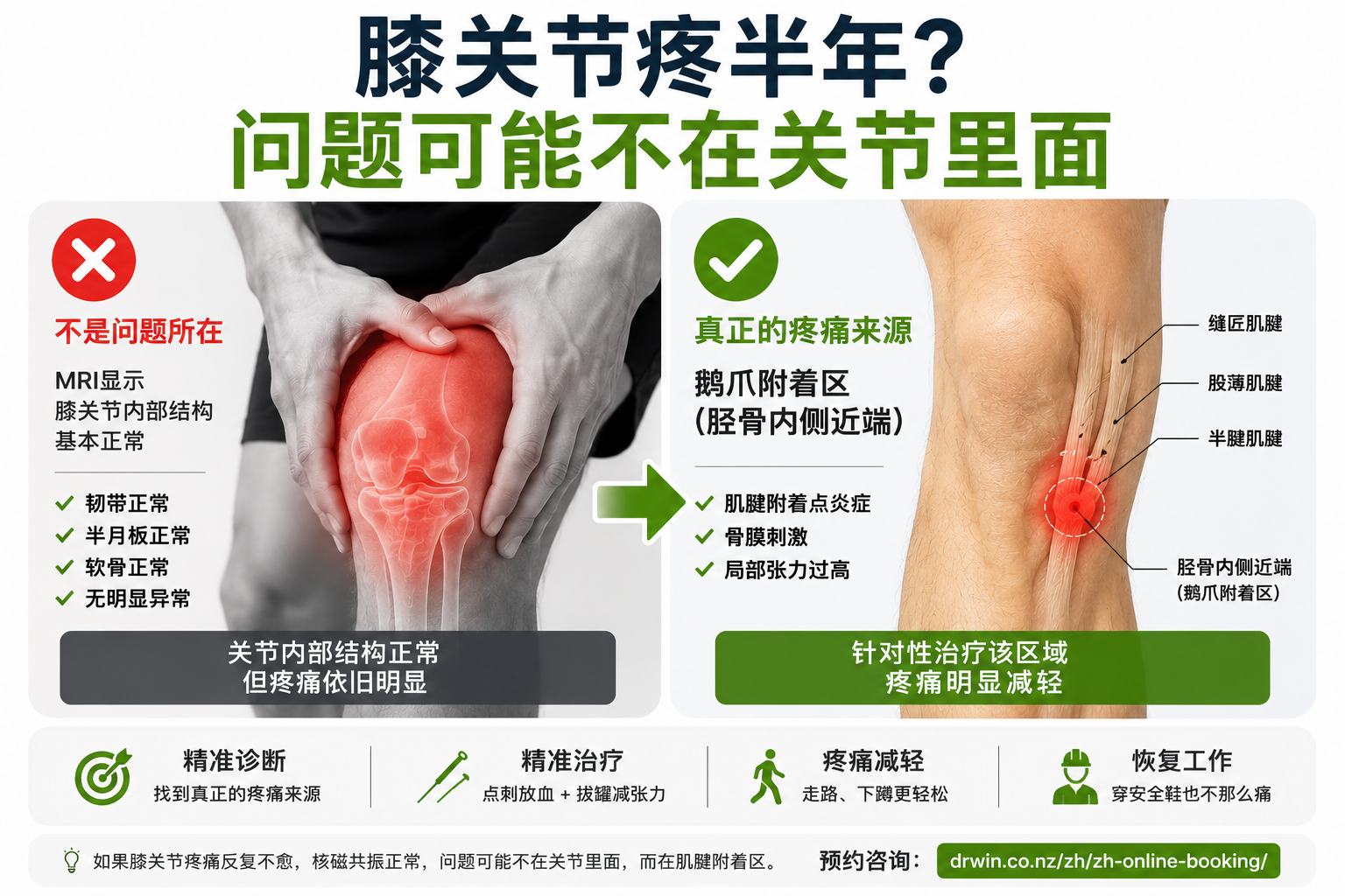 inner knee pain auckland acupuncture