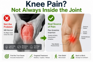 medial knee pain acupuncture auckland