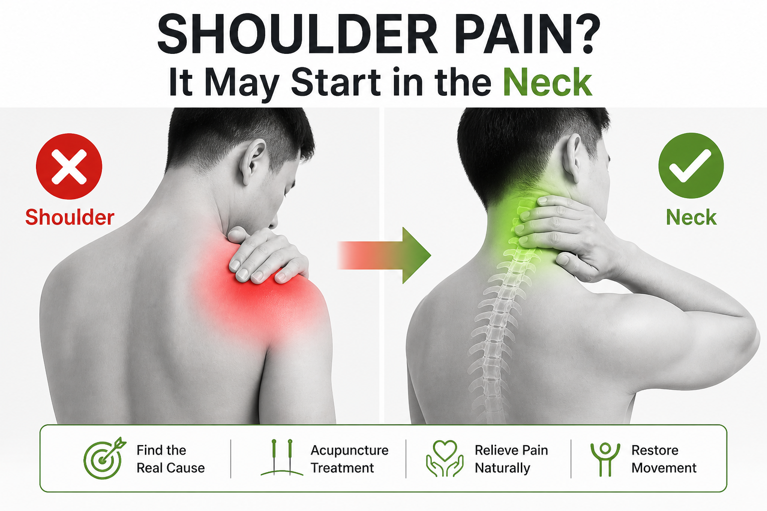 shoulder pain neck auckland acupuncture