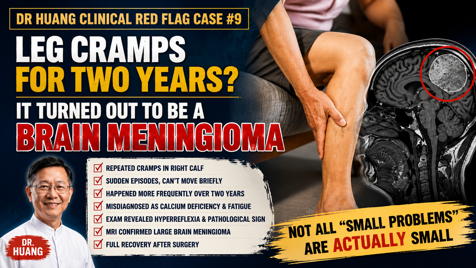 leg cramps brain tumor auckland acupuncture clinic